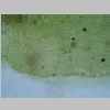 Perichaetial Leaf Base 40er 01.jpg